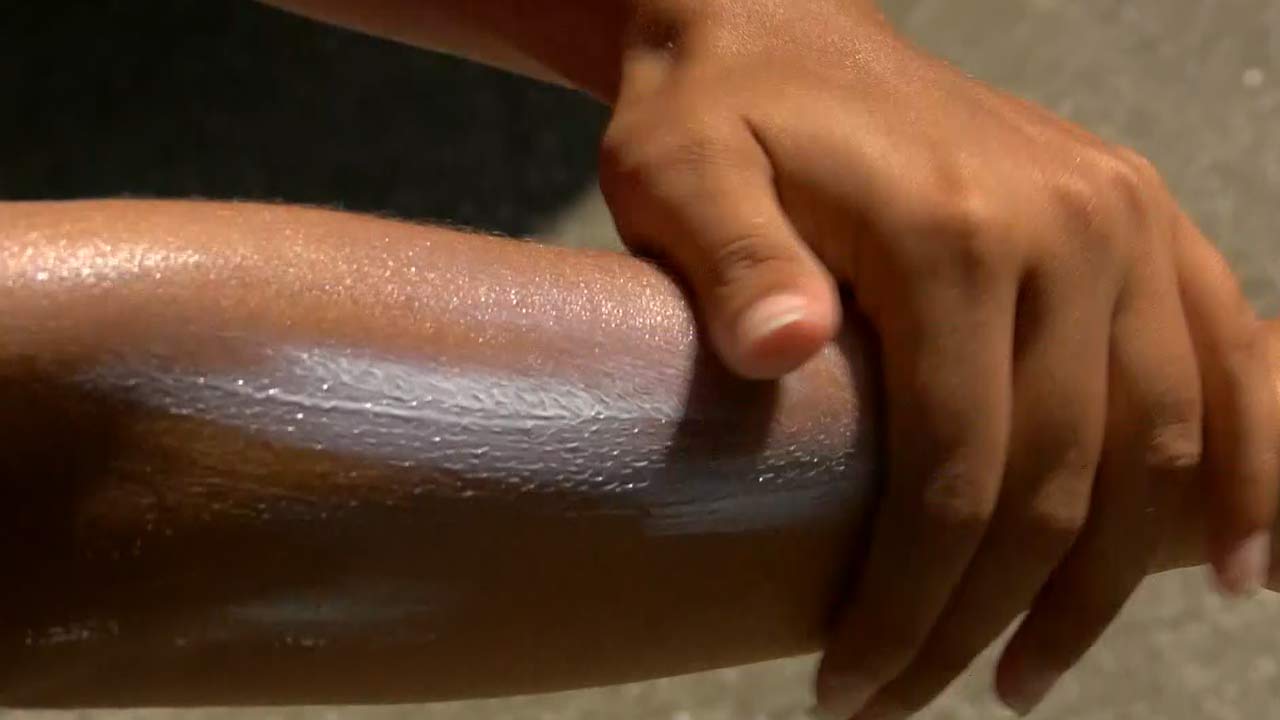 UW Health doctor explains importance of sun safety - Vimarsana News